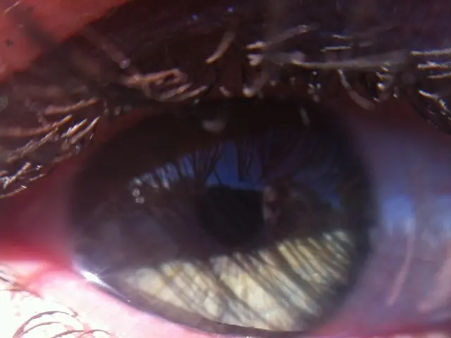 Unveiled secrets: Eye indications pointing towards undetected medical issues